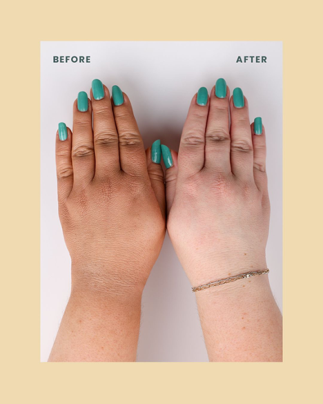 Flawless Body Coverage Before & After hand