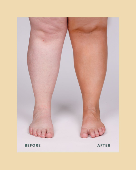 Flawless Body Coverage Before & After leg